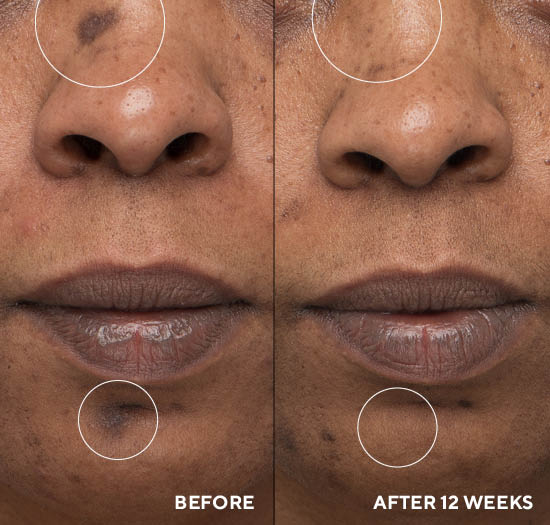 Интервью с эпигенетиком доктором Нилом Китченом о биологической добавке InnerDerm Rx | Alfaspa изображение 6